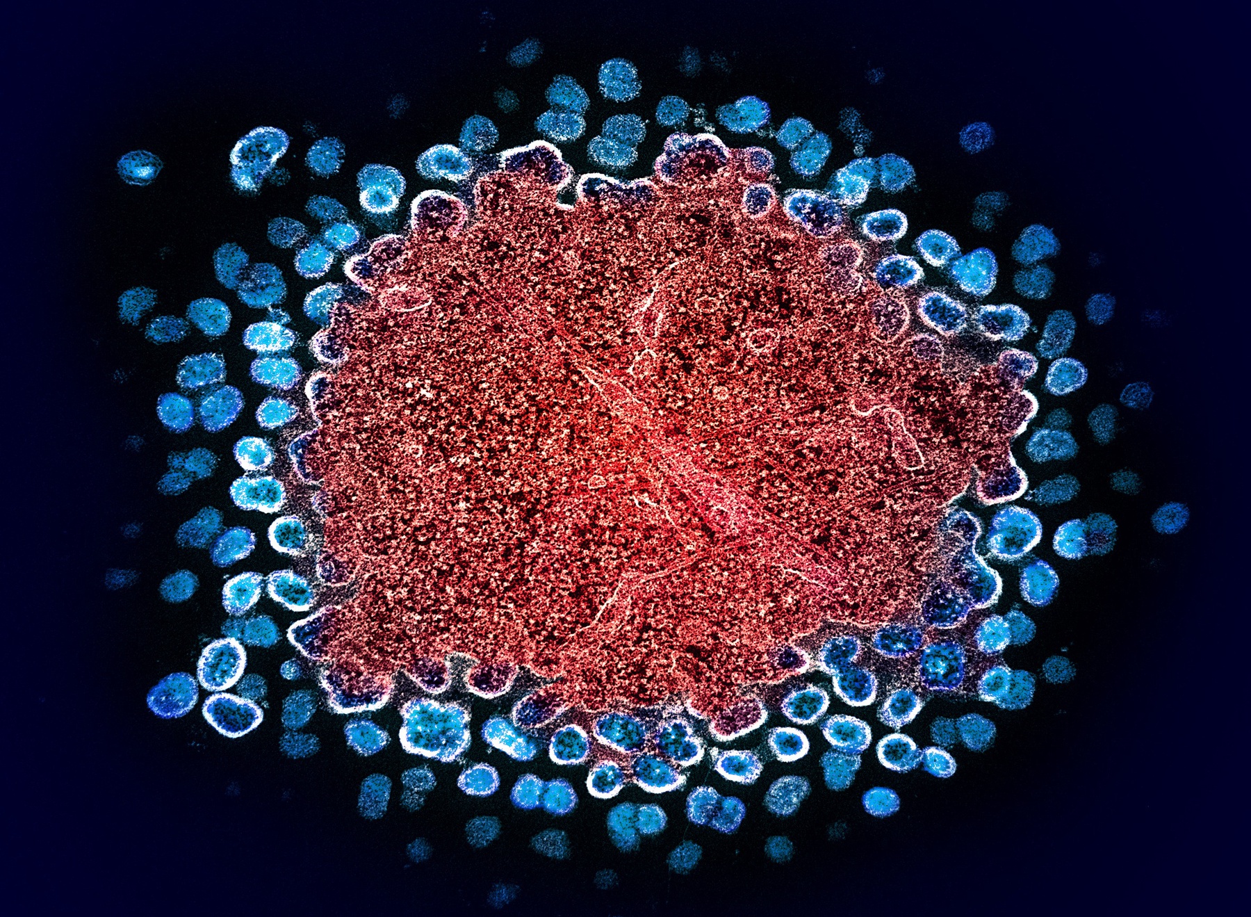 UNAIDS alerta que resposta ao HIV é frágil enquanto novas ferramentas de prevenção mostram alto potencial